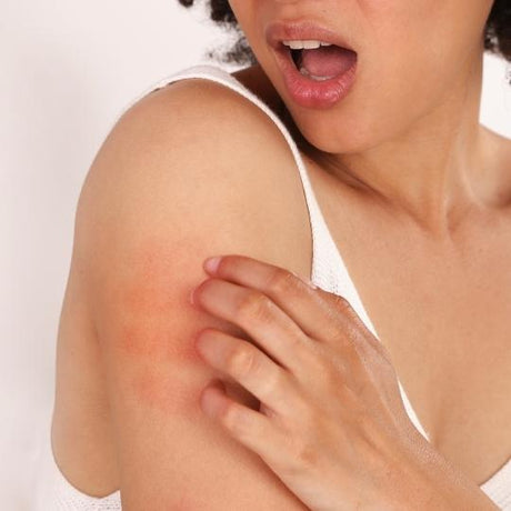Sensitive skin
